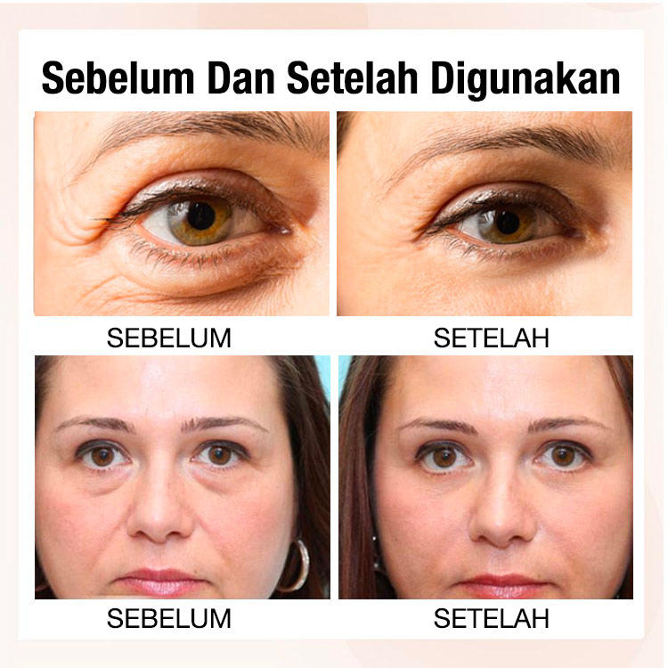 Anti-Wrinkle Eye Serum-direkomendasikan oleh dokter di salon kecantikan Korea-mengurangi kantung mata, lingkaran hitam, menghilangkan kerutan mata-sepuluh tahun lebih muda dalam tujuh hari